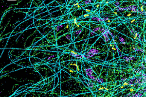 Spectrally resolved super-resolution microscopy image of four sub-cellular targets that were labelled by four far-red dyes at 10-nm spectral separation. Colour is used to indicate the measured fluorescence emission position of each single molecule. (Scale bar: 1 µm) Spectrally resolved super-resolution microscopy image of four sub-cellular targets that were labelled by four far-red dyes at 10-nm spectral separation.
