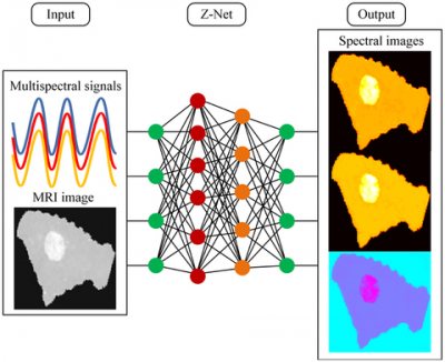 Researchers developed the Z-Net deep-learning algorithm for real-time reconstruction of images that combine spectral and MRI data. This could allow better breast cancer screening and diagnosis. Credit: Keith Paulsen, Dartmouth College Diagram of the deep learning process