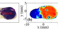 Pathology image, left, and corresponding terahertz image, right, of excised tissue from mouse breast tumour. Photo submitted by the researcher.