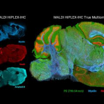 Novel multiomic imaging enhances spatial high-plex protein imaging with the ability to elucidate metabolic processes in the same tissue section. In addition to mapping tens to over one hundred targeted proteins with high-plex peptide tags, MALDI HiPLEX-IHC can track signalling pathways such as glycosylation, observe lipid spatial profiles for tumour microenvironment segmentation, or simultaneously observe how drugs affect both protein and metabolic states.