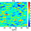 Distribution of Ca, S and Fe in a section of diffuse astrocytoma. Image: Diamond Light Source